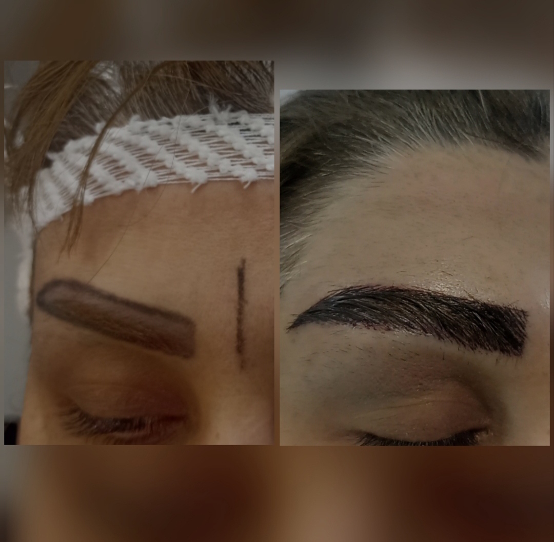 کاشت ابرو طبیعی